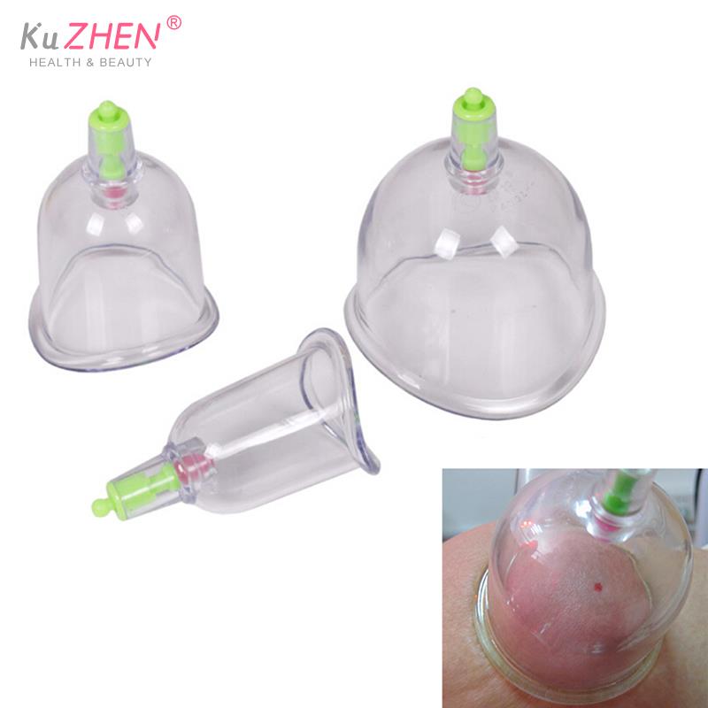 Tradisional 3 Cangkir Kangzhu  - Medical Lab Equipments ulasan dan harga